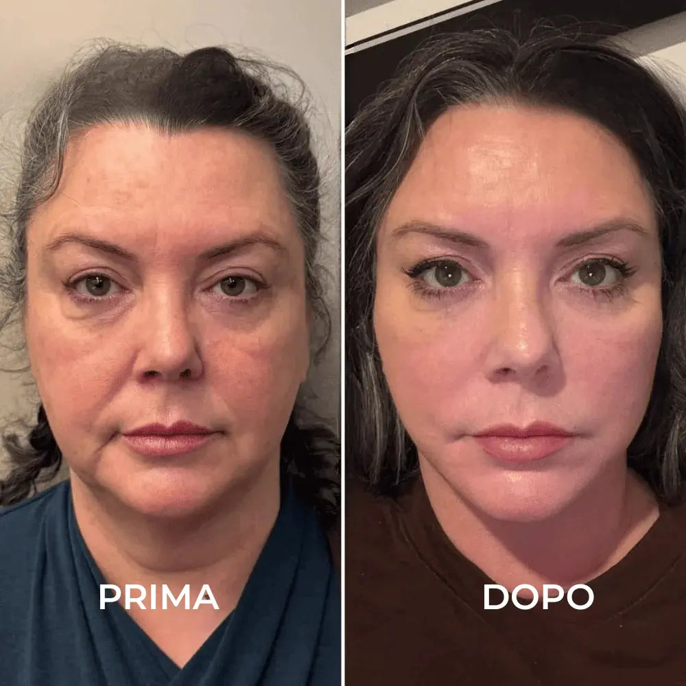 SoraSculpt – Spazzola per il viso