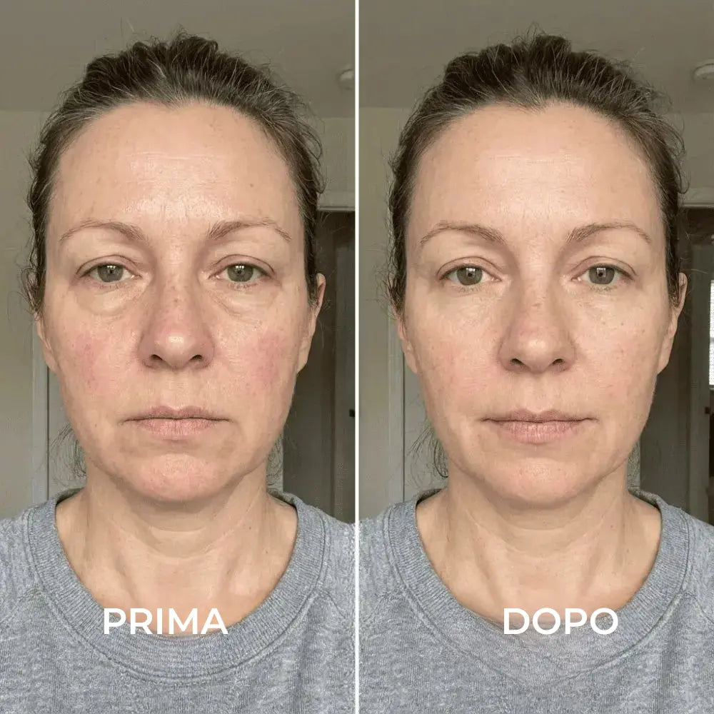 SoraSculpt – Spazzola per il viso